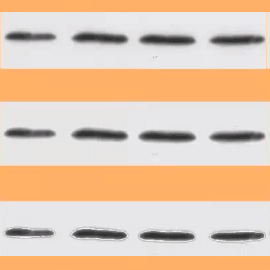 Polyacrylamide gel electrophoresis project